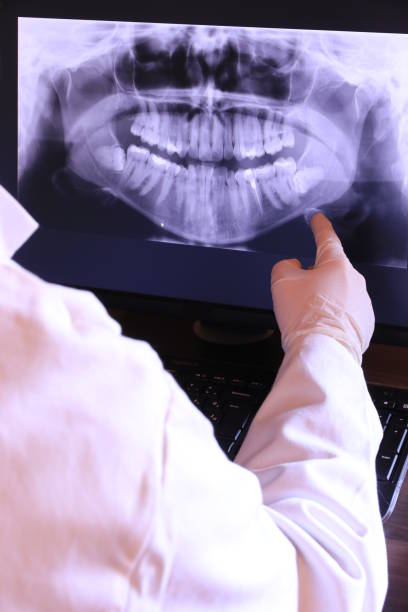 Best Emergency Dentist for Knocked-Out Tooth in Northlake, SC